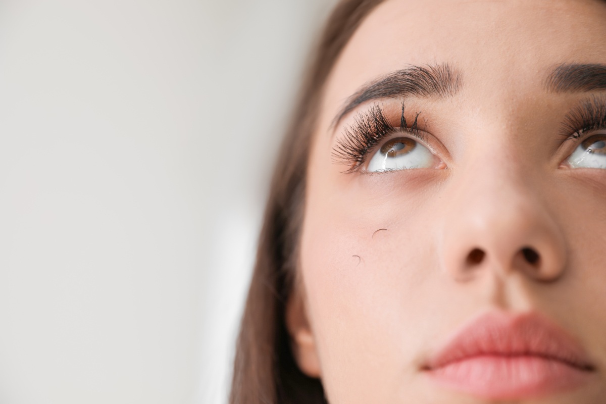 Une femme ayant un problème de perte de cils
